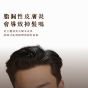 Scalp_seborrheic_dermatitis